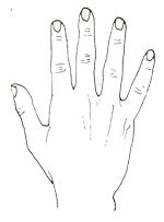 원추형(圓錐形)의 손